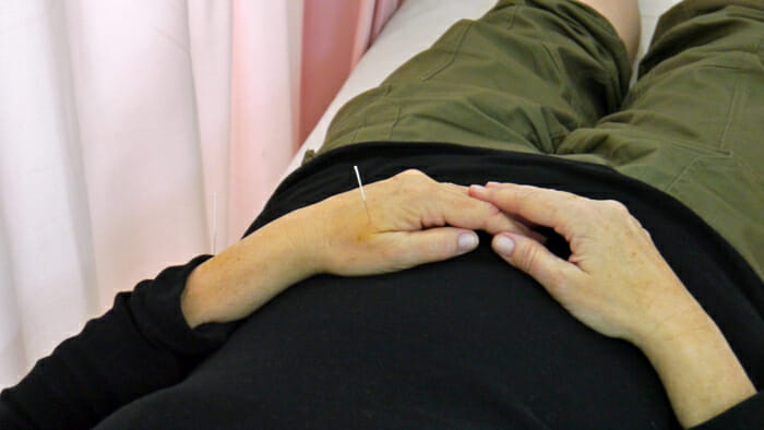 I received acupuncture when I experienced a travel health emergency in China